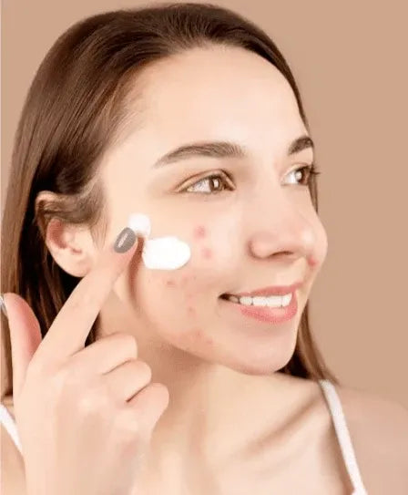 Aichun Beauty Acne Treatment Gel 20g Dubai UAE lightweight acne care gel for clearer looking skin and everyday facial skincare routine