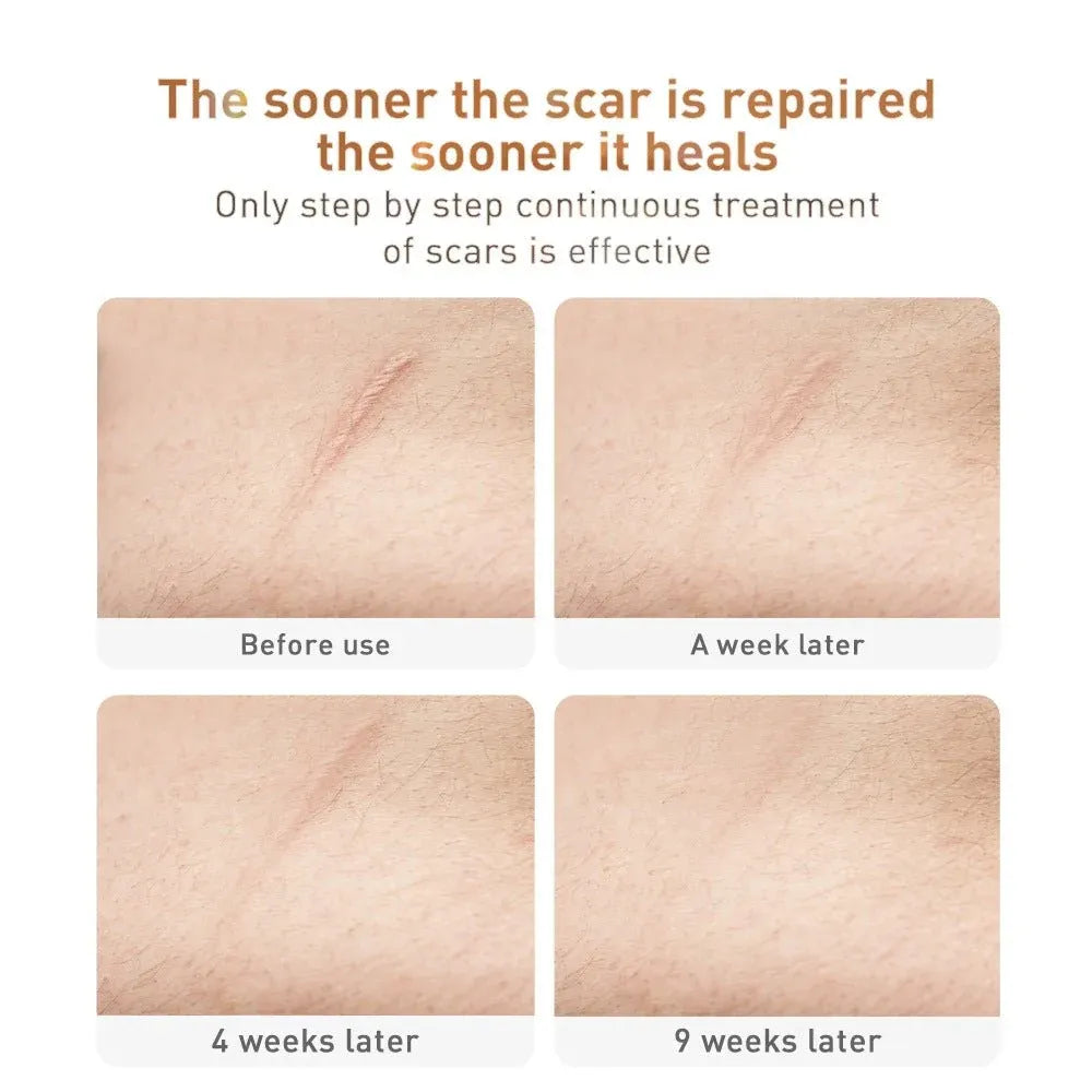 Herbal Scar Repair Gel with Witch Hazel Dubai UAE herbal scar repair gel with witch hazel for smoother looking skin and daily scar care