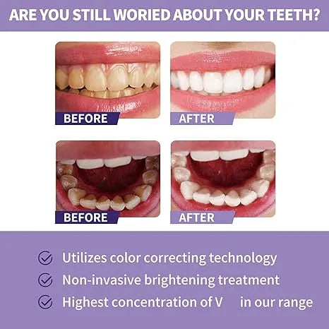 Whitening Toothpaste 30ml for Fresh and Brighter Teeth Dubai UAE whitening toothpaste for cleaner looking teeth fresh breath and everyday oral care