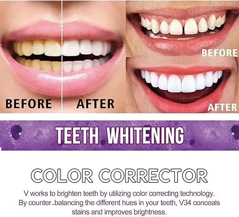 Whitening Toothpaste 30ml for Fresh and Brighter Teeth Dubai UAE whitening toothpaste for cleaner looking teeth fresh breath and everyday oral care